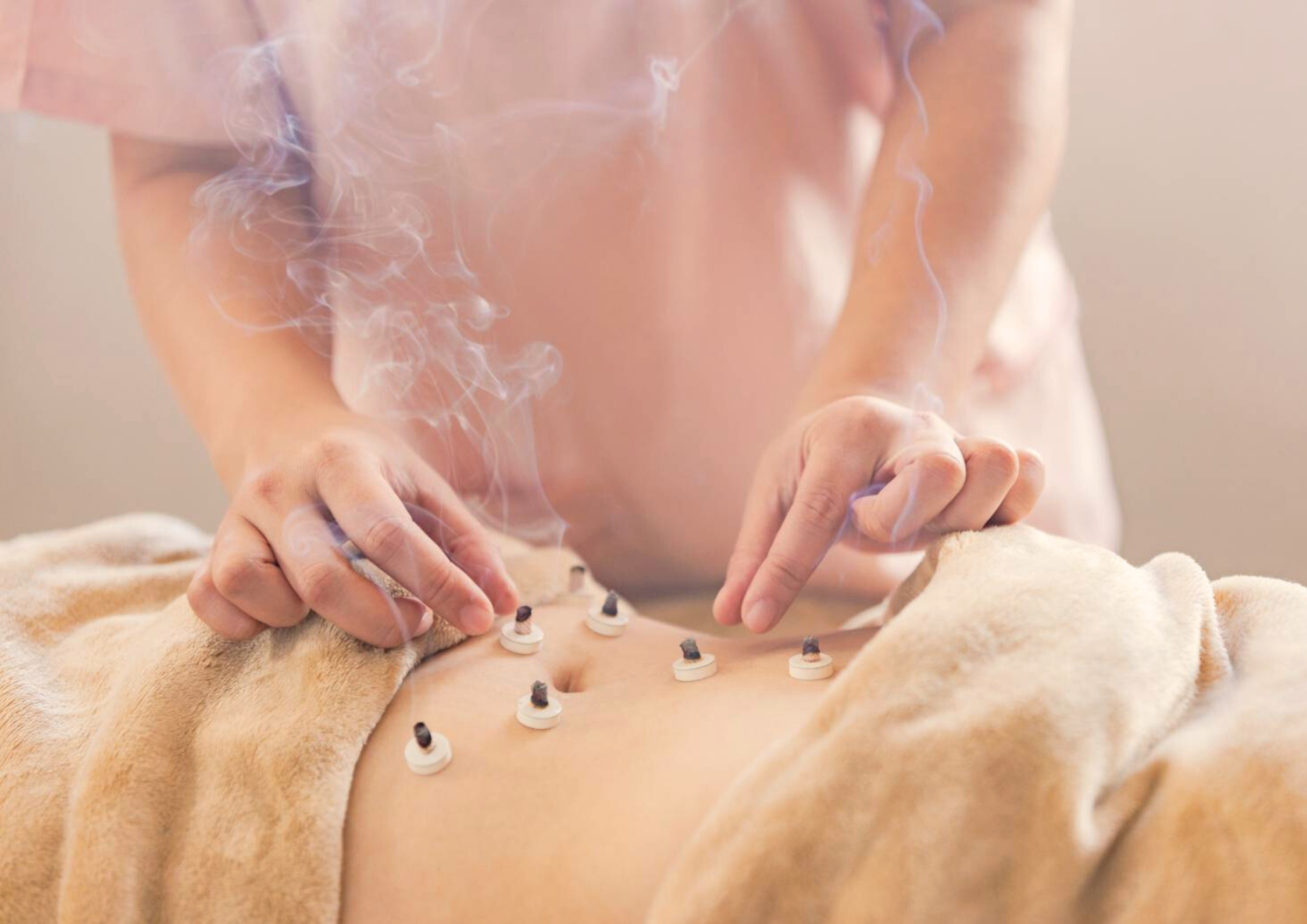 美容鍼灸サロンNaturalHarry 妊活体質改善ケアコース鍼灸全身治療　60分のメニュー画像