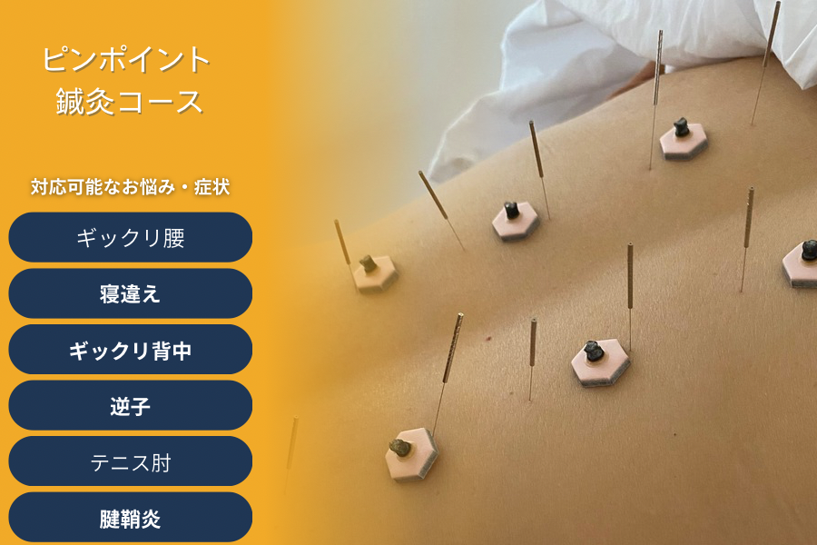 鍼灸院　侑秀　NIIGATA （新規限定）ピンポン鍼灸コースのメニュー画像