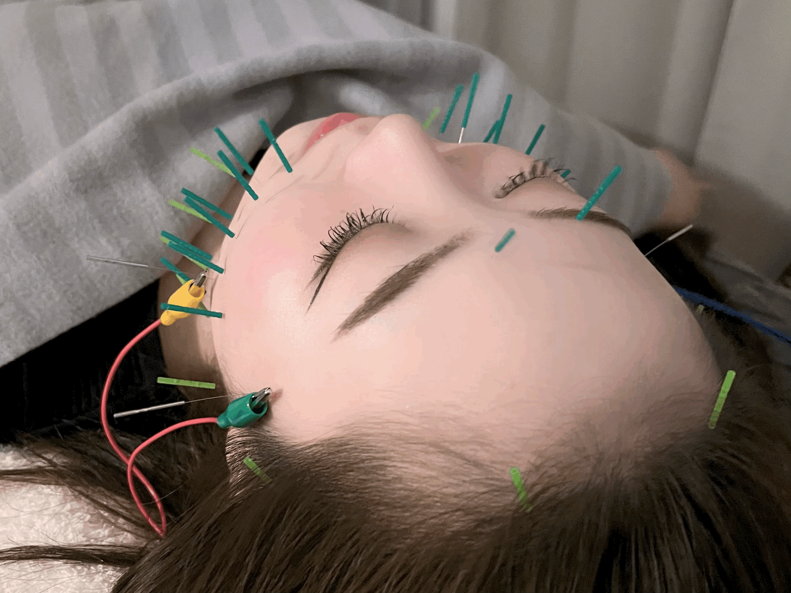 美容鍼灸サロンHaripure 【再来】美容鍼スタンダードコースのメニュー画像