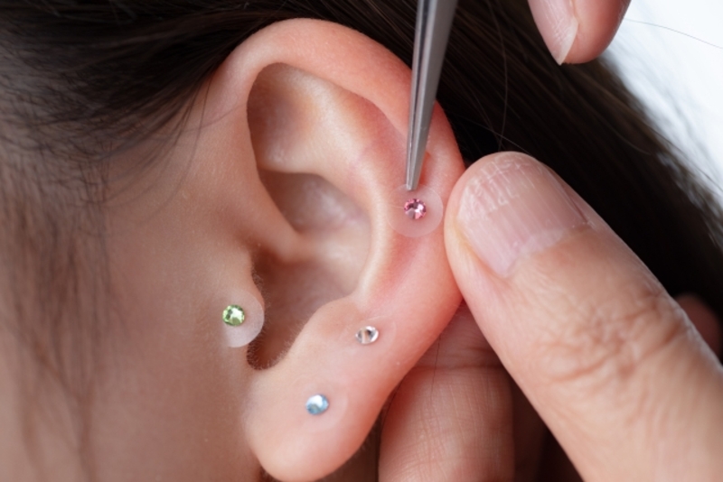 なごみ鍼灸整骨院（王子公園） 耳ツボ＋全身整体コースのメニュー画像