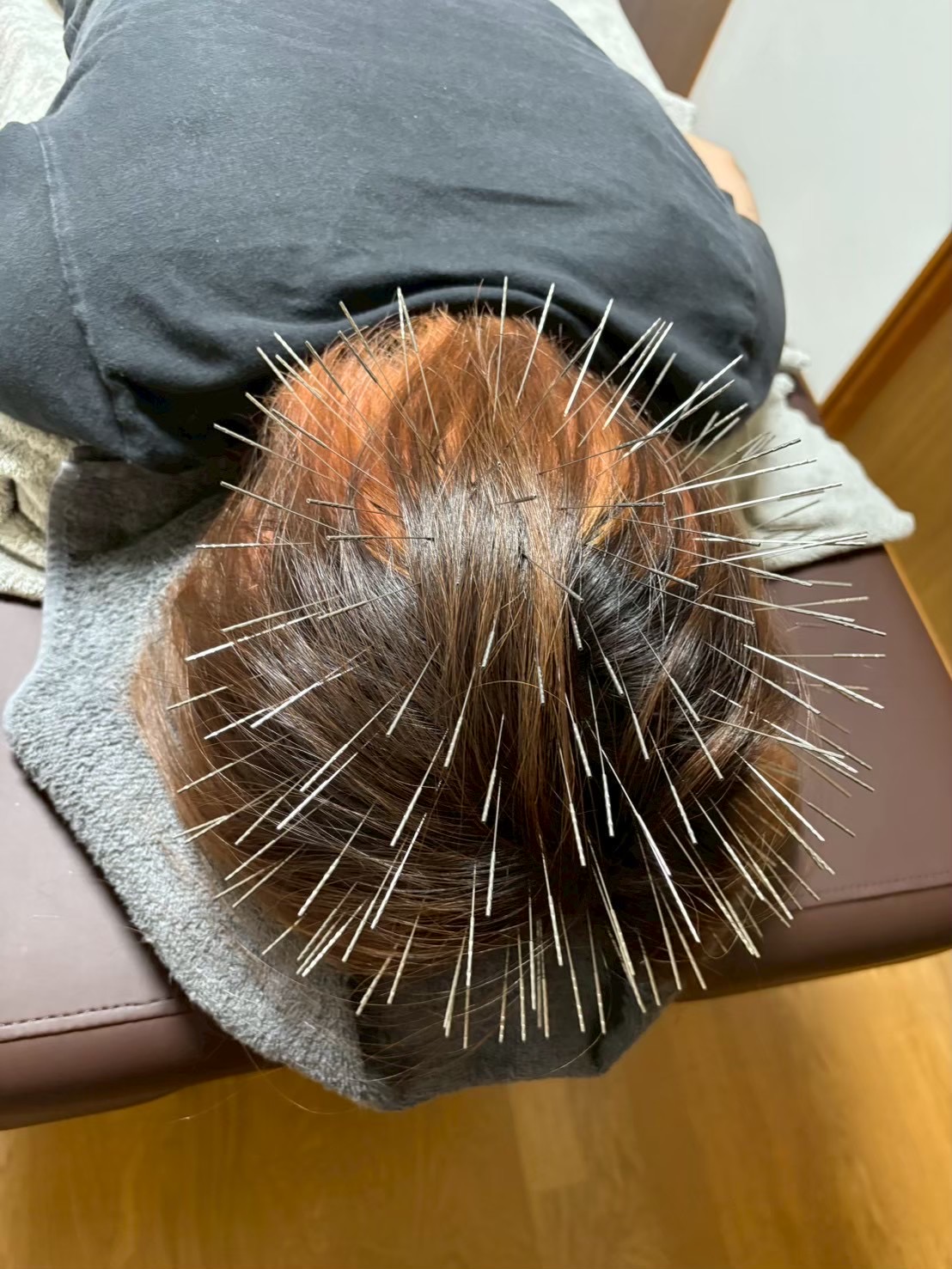 鍼打人　Aomori    ルート治療 頭集中コースのメニュー画像