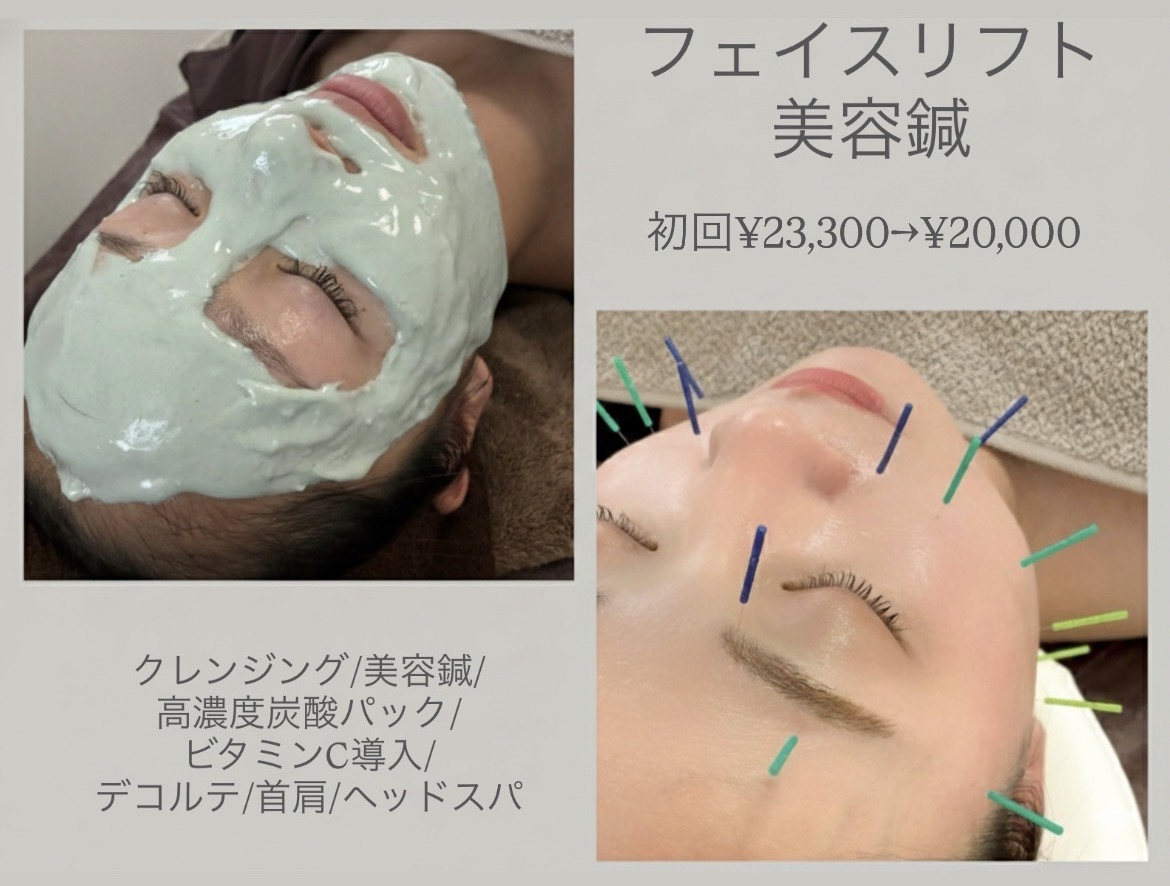 鍼灸サロンATHREE(アスリー)恵比寿 【初回】フェイスリフト美容鍼のメニュー画像