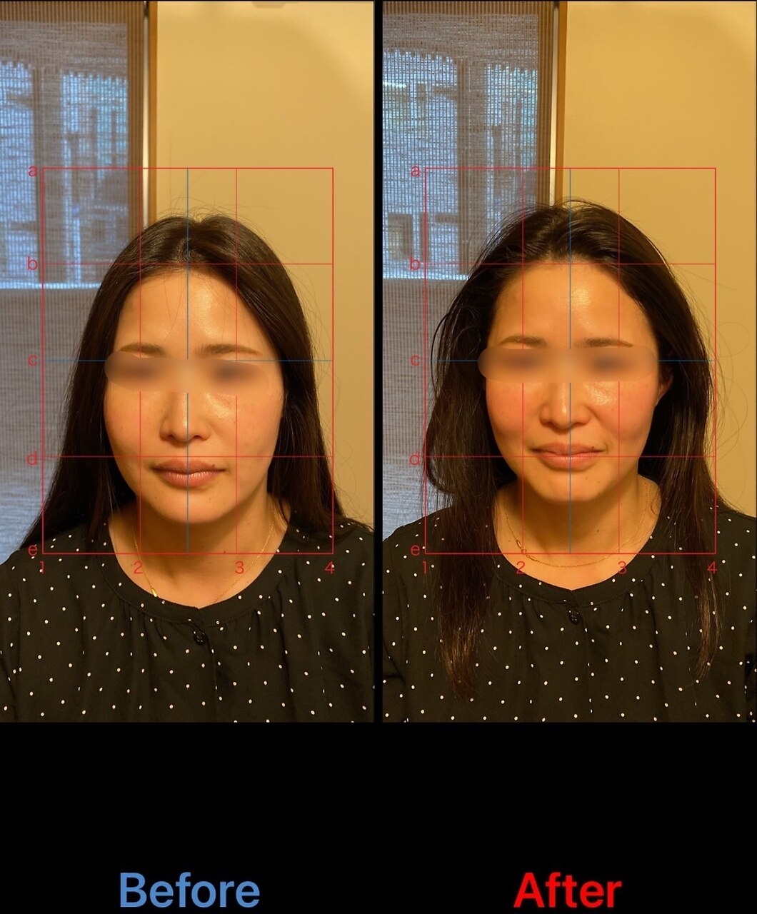 伝統鍼灸喜心堂 五臓・巡り美容鍼コース(2月限定体験価格)通常初回15000円のメニュー画像