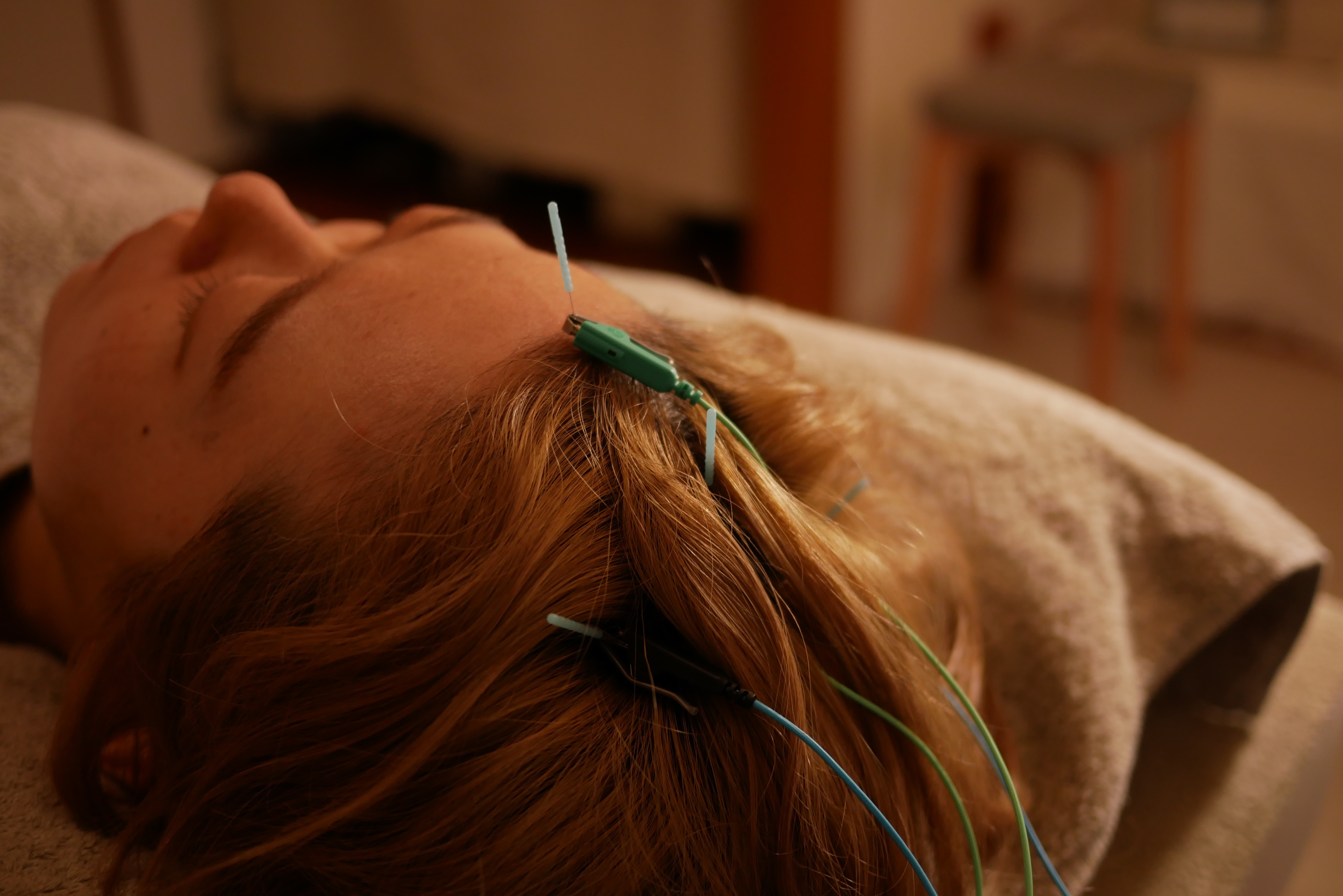 鍼灸マッサージ 眠り猫 眠り鍼のメニュー画像