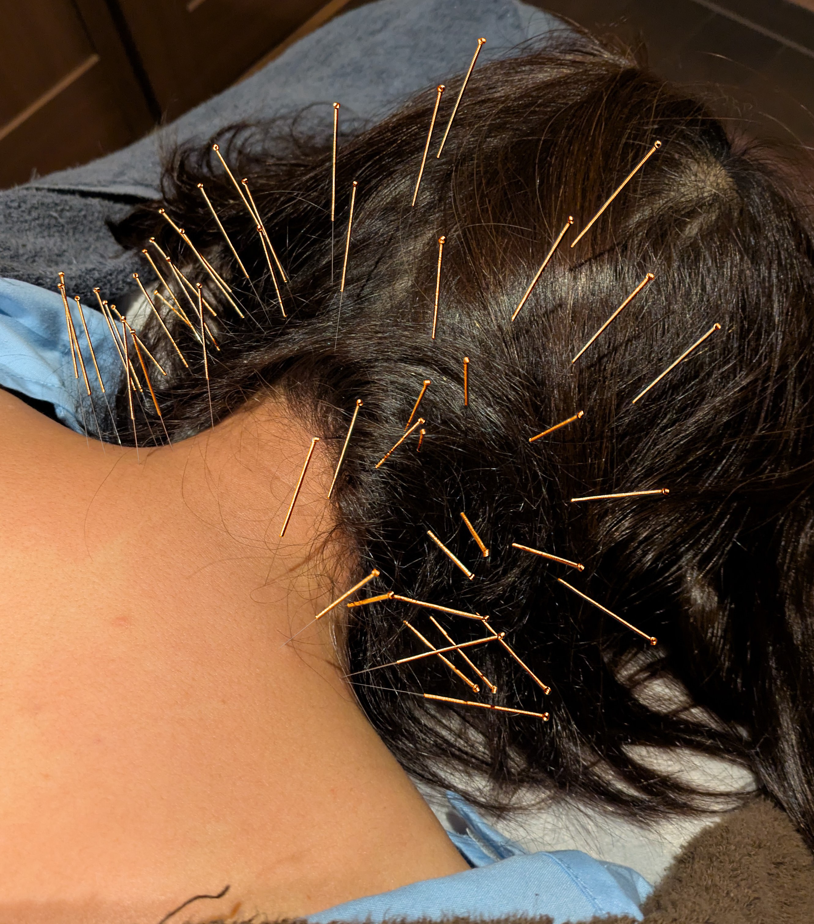 竜崎鍼灸治療院 伝統中医しんきゅうコース【局所】のメニュー画像