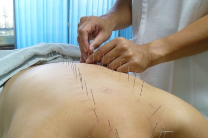 竜崎鍼灸治療院 伝統中医はりきゅうコース【全身】のメニュー画像