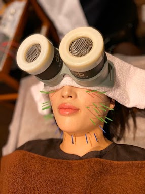 竜崎鍼灸治療院 美容はりきゅうコースのメニュー画像