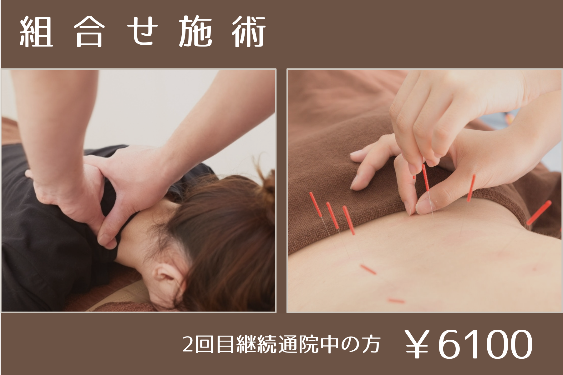 那覇市新都心スマイルなごみ鍼灸整骨院 【2回目以降の方】組み合わせ施術のメニュー画像