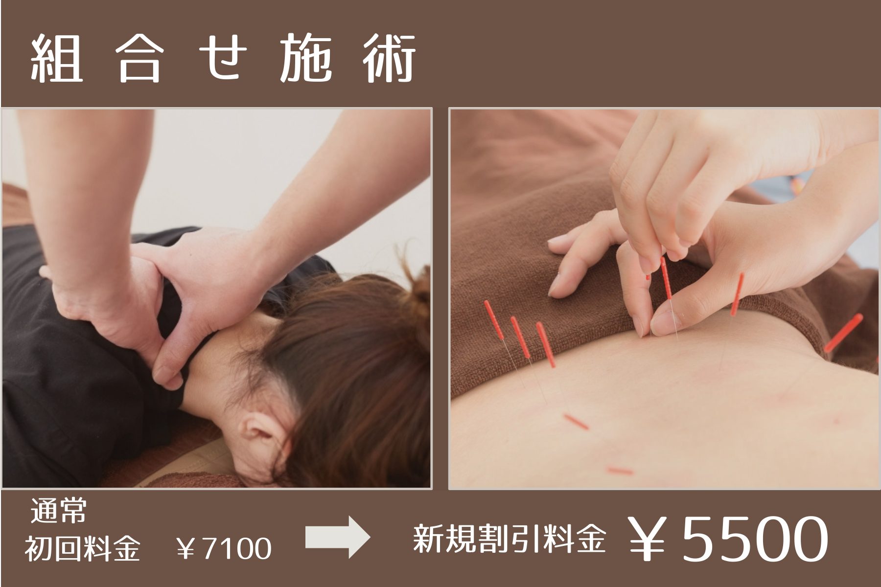那覇市新都心スマイルなごみ鍼灸整骨院 【新規限定割】組み合わせ施術のメニュー画像