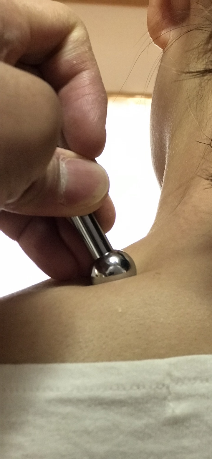 鍼灸LUCIA つらい肩こり解放コースのメニュー画像