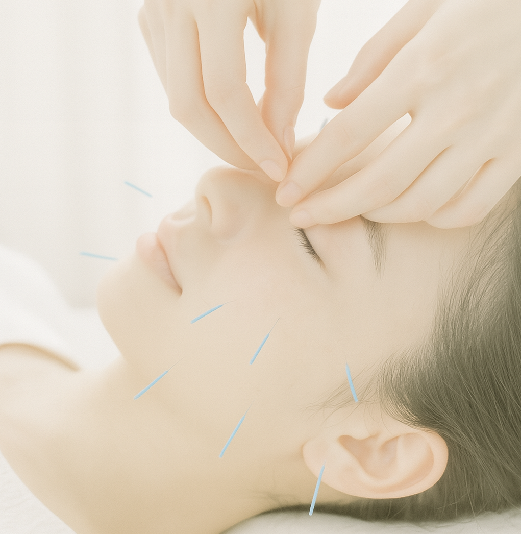 女性専門鍼灸・美容鍼 ひろせ治療院 美容鍼のメニュー画像
