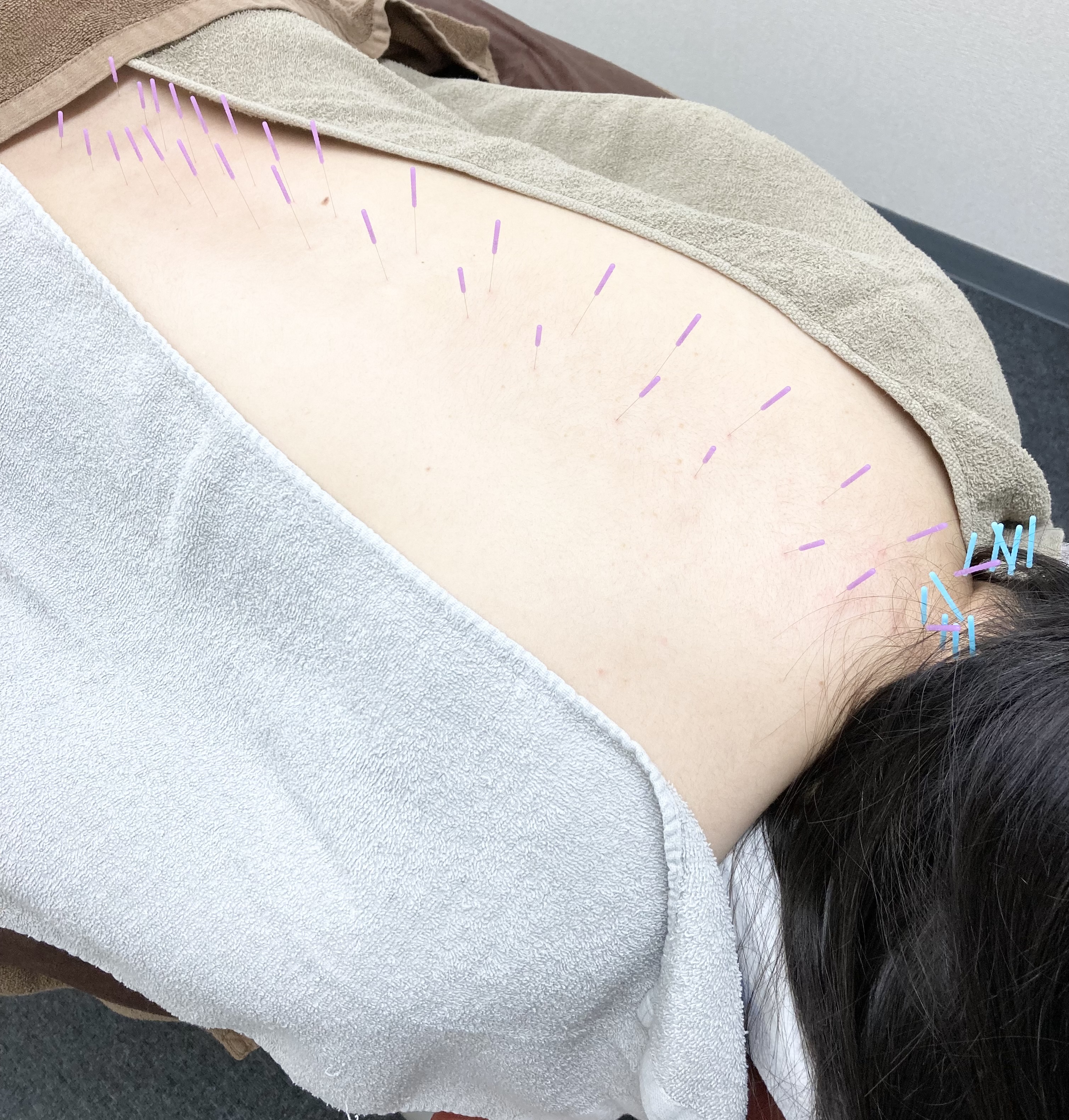 サボテン鍼灸マッサージ院 【初回限定】鍼灸マッサージ90分のメニュー画像