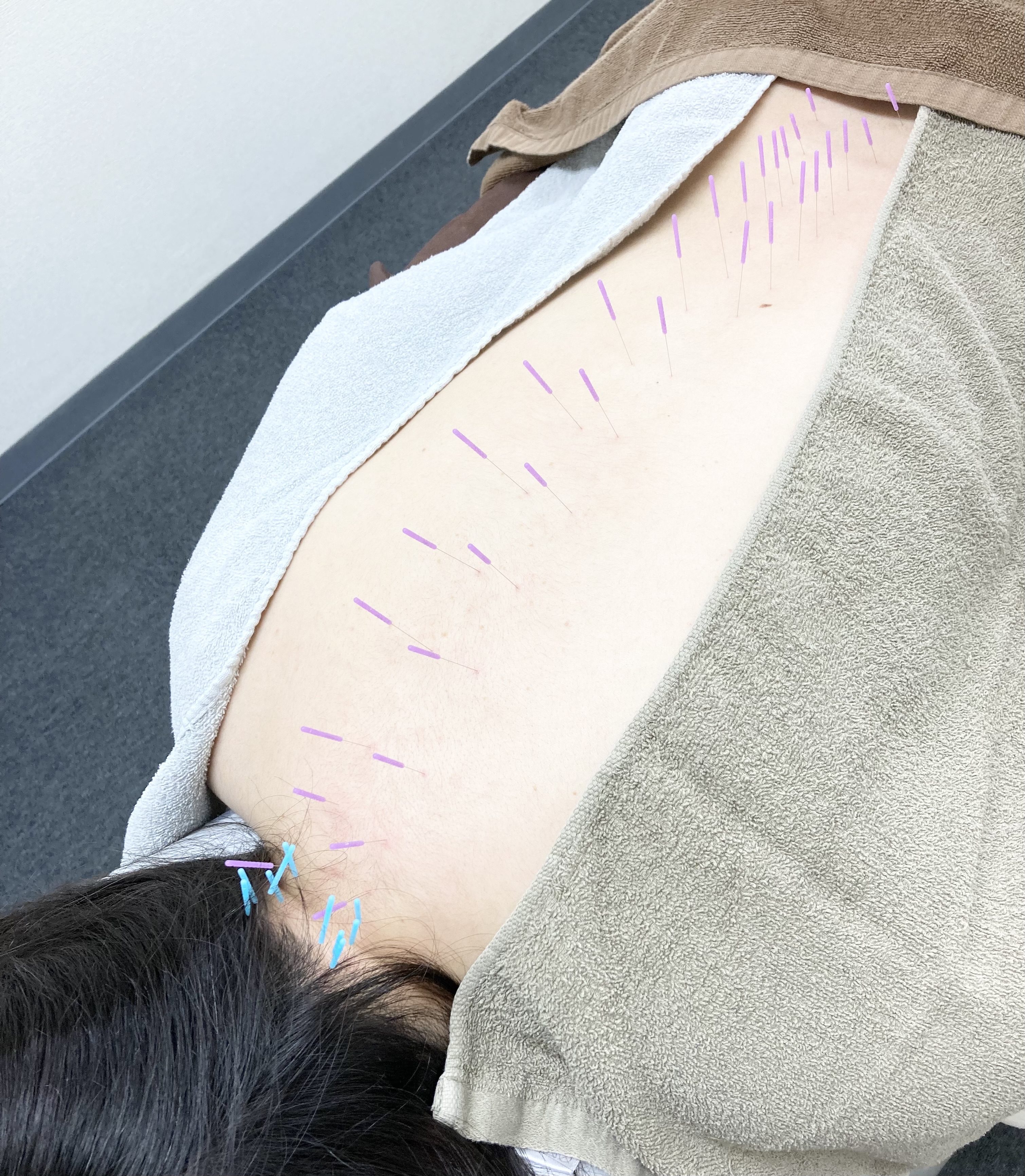 サボテン鍼灸マッサージ院 鍼灸マッサージ75分のメニュー画像