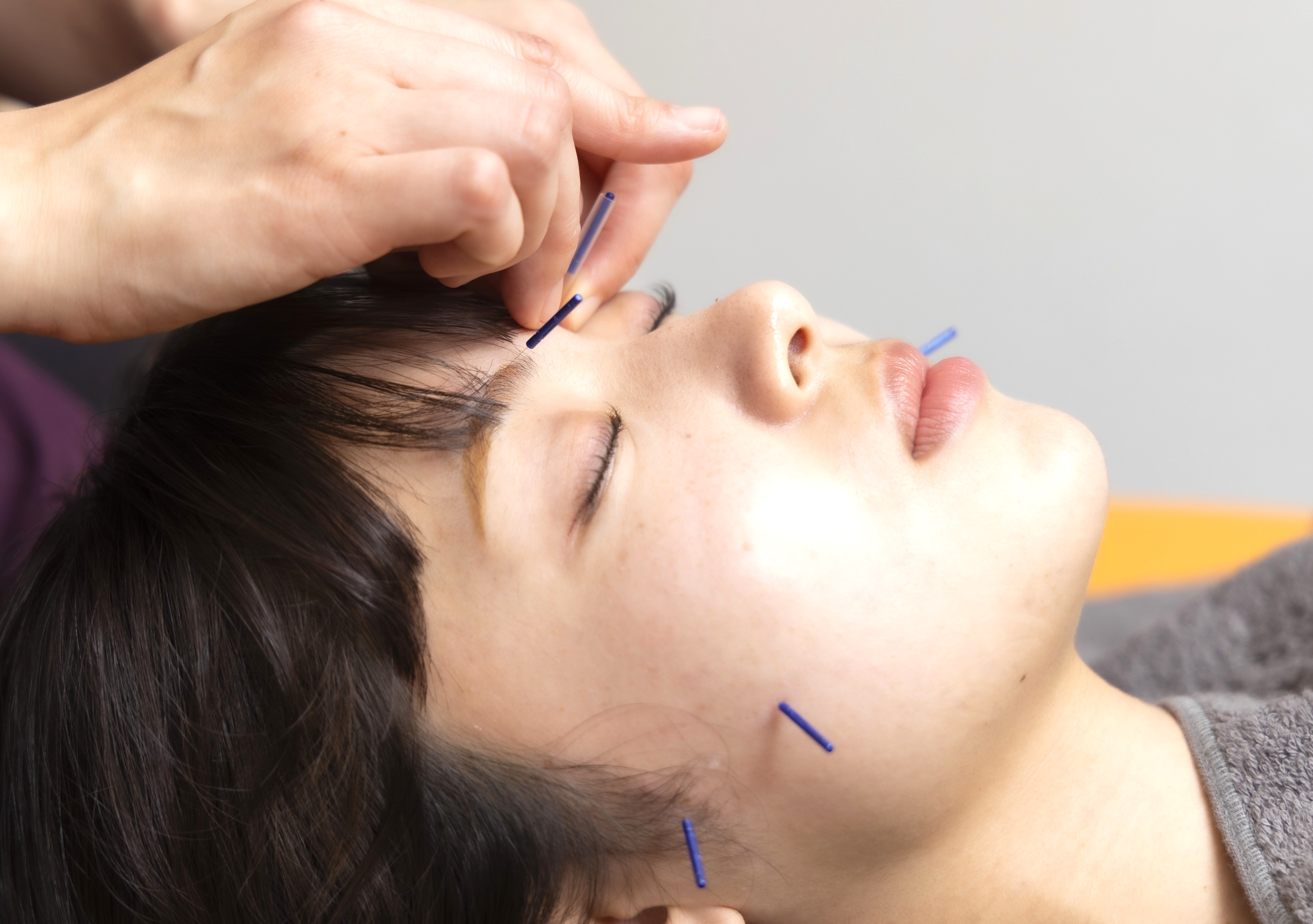 東垣鍼院 基本＋美容はり治療のメニュー画像