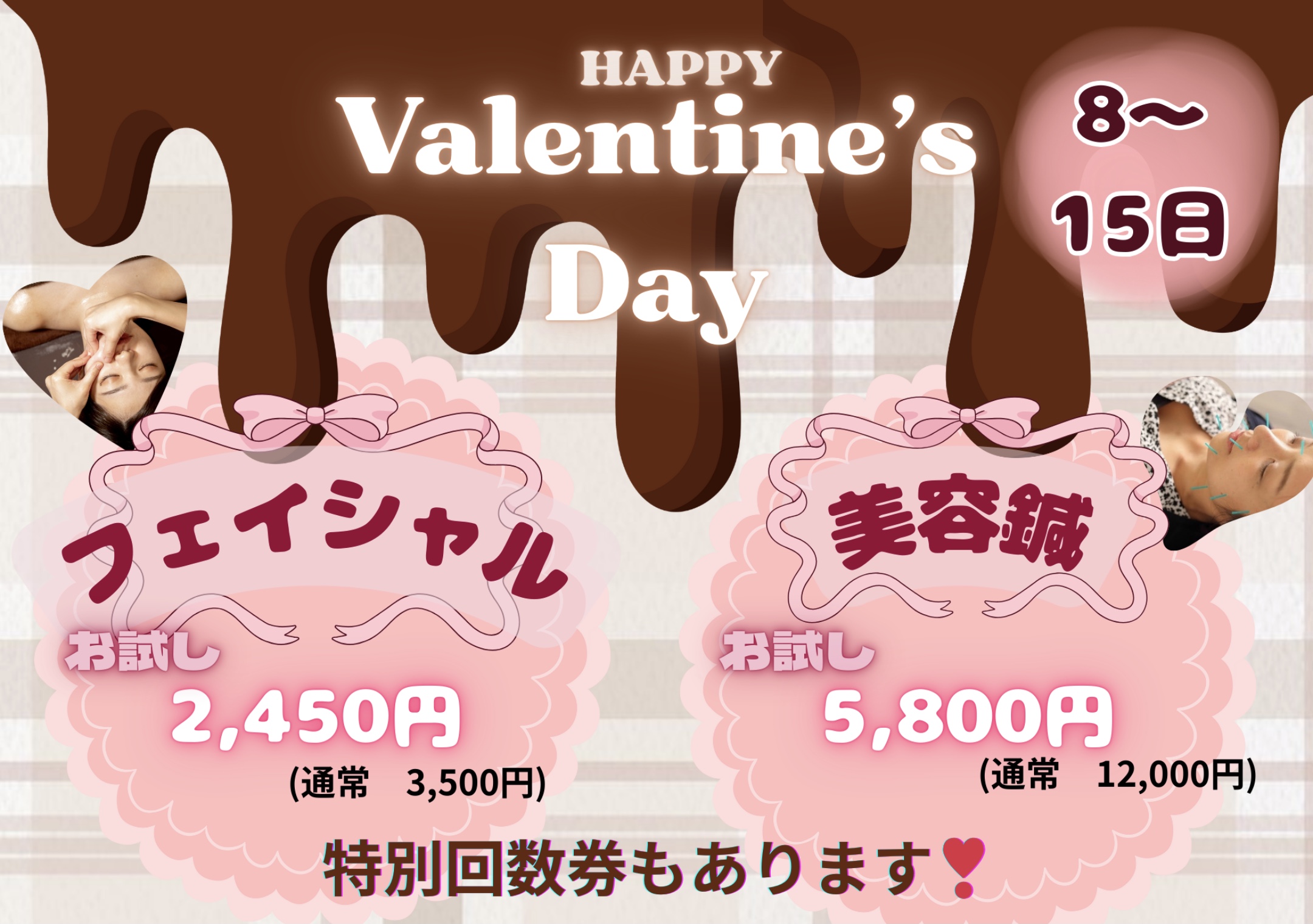 六花鍼灸整骨院 川端本店 バレンタインキャンペーン！のメニュー画像