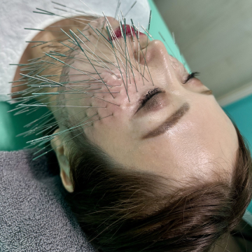 高宮レディース鍼灸整骨院 【初回限定・平日限定】肌分析付・パック付｜美容鍼60分又は小顔矯正60分 ¥18,700→¥5,980のメニュー画像