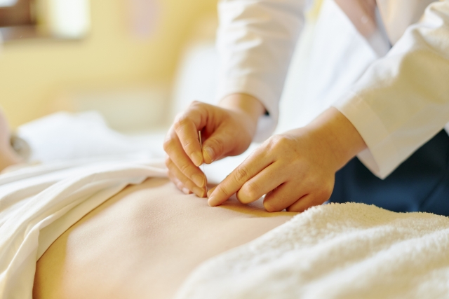 Acure鍼灸院 北京堂姫路 追加の鍼灸 30分のメニュー画像