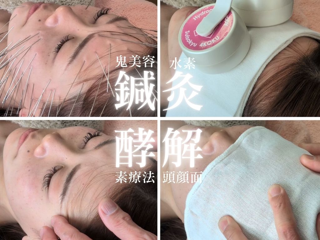 【土佐】鍼　もりさわ治療院 ”新しい美容鍼”【『抗酸化』鬼美容鍼】40のメニュー画像