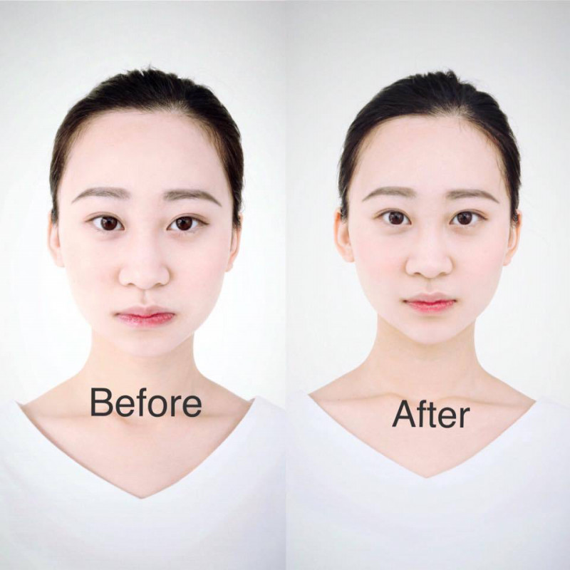 イスクラ中医鍼灸院 【迷ったらこちら】オーダーメイド鍼＋整体のメニュー画像