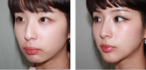 イスクラ中医鍼灸院 【根本改善】オーダーメイド鍼灸＋整体のメニュー画像