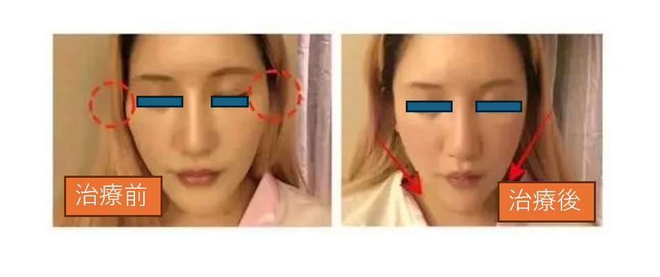 イスクラ中医鍼灸院 【内側から整える】美容鍼＋小顔＋整体のメニュー画像