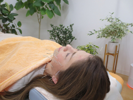 たかはし鍼灸接骨院 電気を流す美容鍼＋鍼20本のメニュー画像