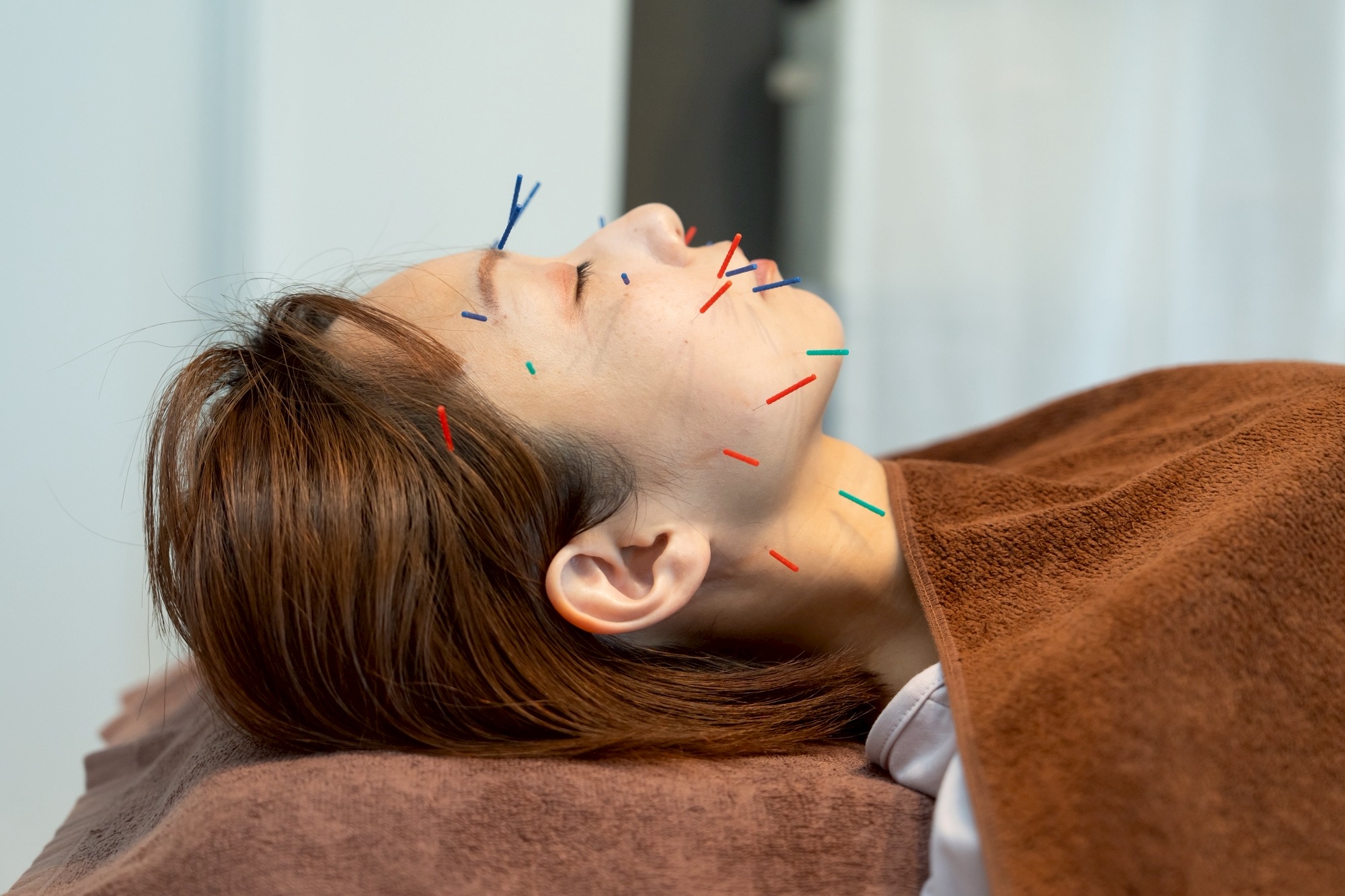 鍼灸ugi- 美容鍼灸　スタンダードのメニュー画像