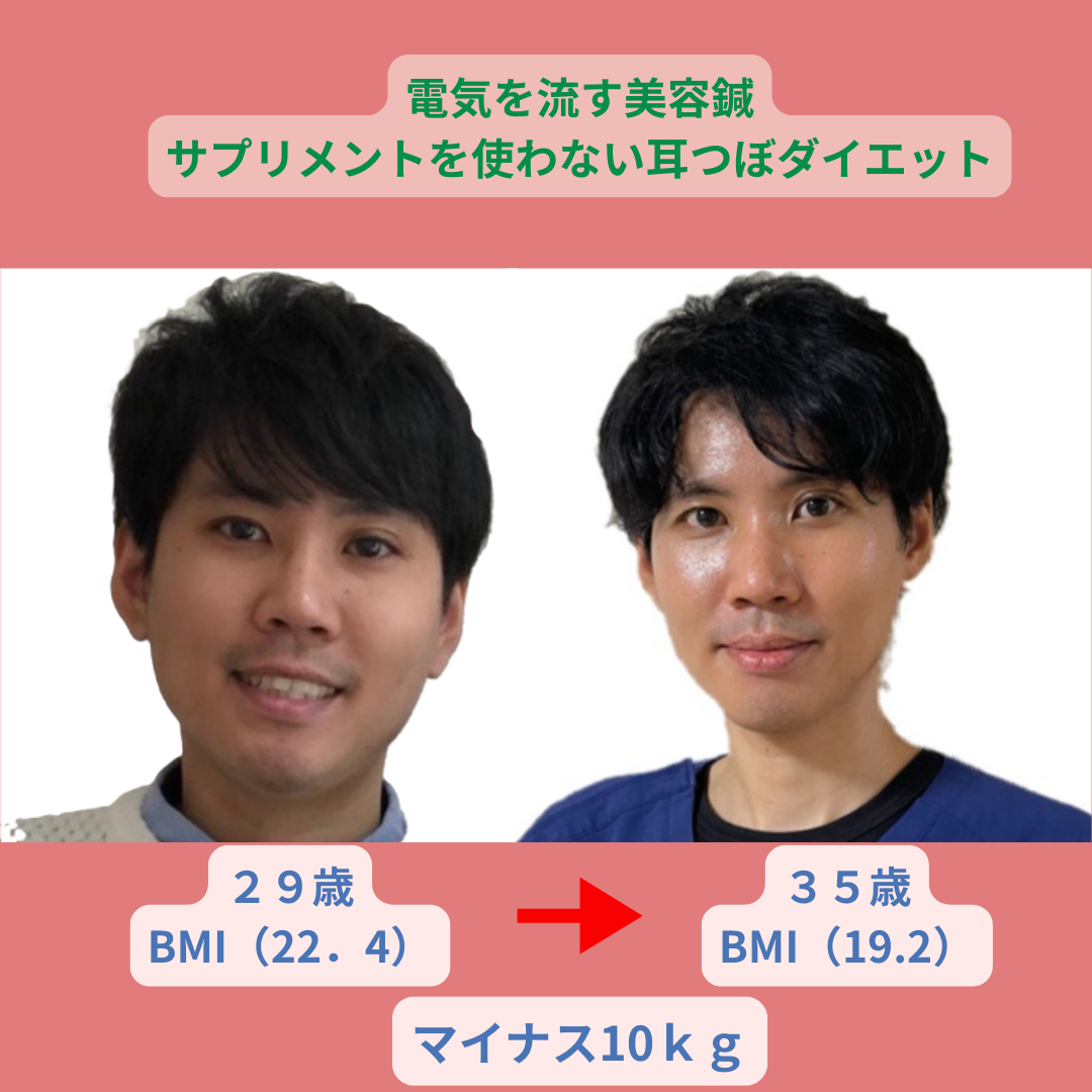 鍼灸マッサージ・美容鍼・ダイエット　藤井治療院 （初診）サプリメントを使わない耳つぼダイエットのメニュー画像