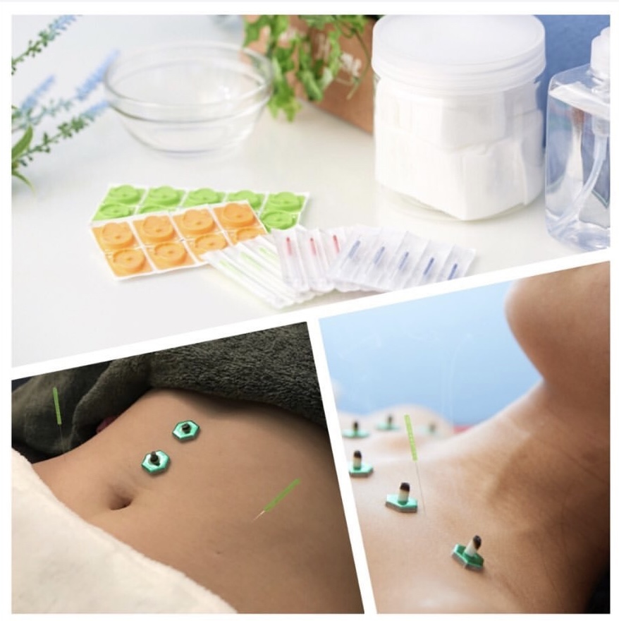 sen ｜完全予約制｜女性専用｜美容鍼・鍼灸・整体｜ 【初回10%オフ】全身スッキリケアのメニュー画像