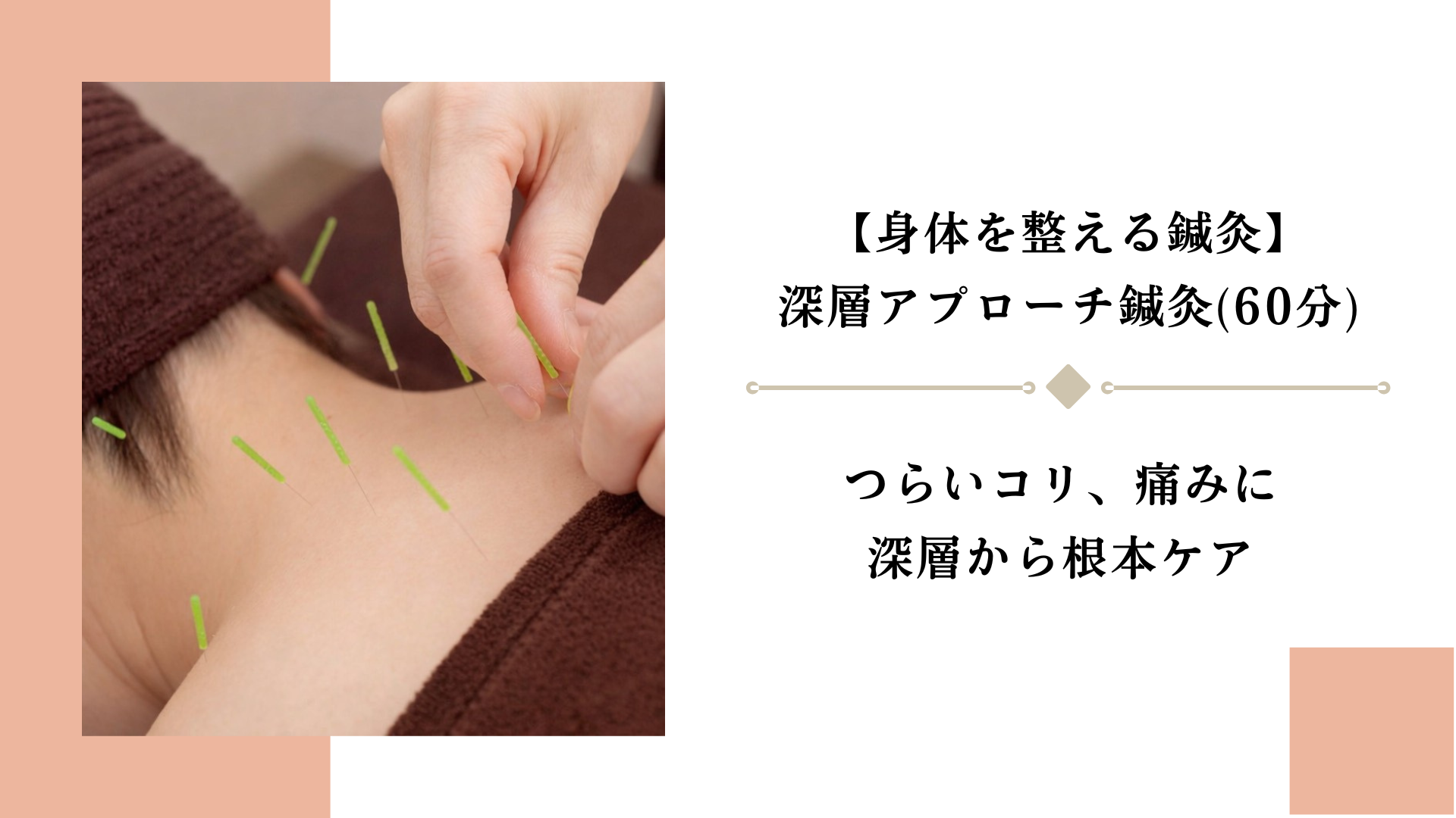 女性のための美容鍼灸サロン｜BEAUTE ボーテ 身体を整える鍼灸｜深層アプローチ鍼灸(60分)のメニュー画像