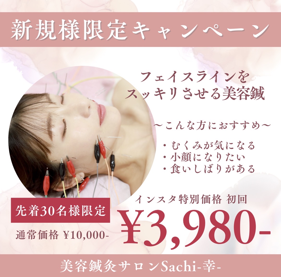 美容鍼灸サロン　Sachi-幸- 【新規様限定】電気を流す美容鍼のメニュー画像