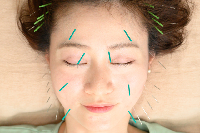 はり灸院こうえい ◇定番コース◇美容鍼灸スタンダード40のメニュー画像