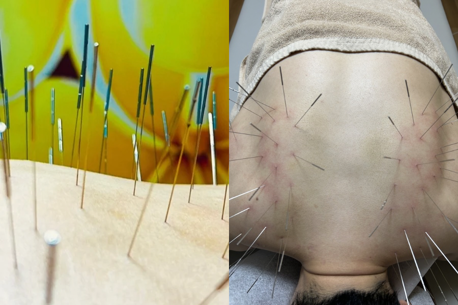 鍼処KAKUREGA 『30分　各局所症状』　1ヶ月以内の再来店は7700円のメニュー画像