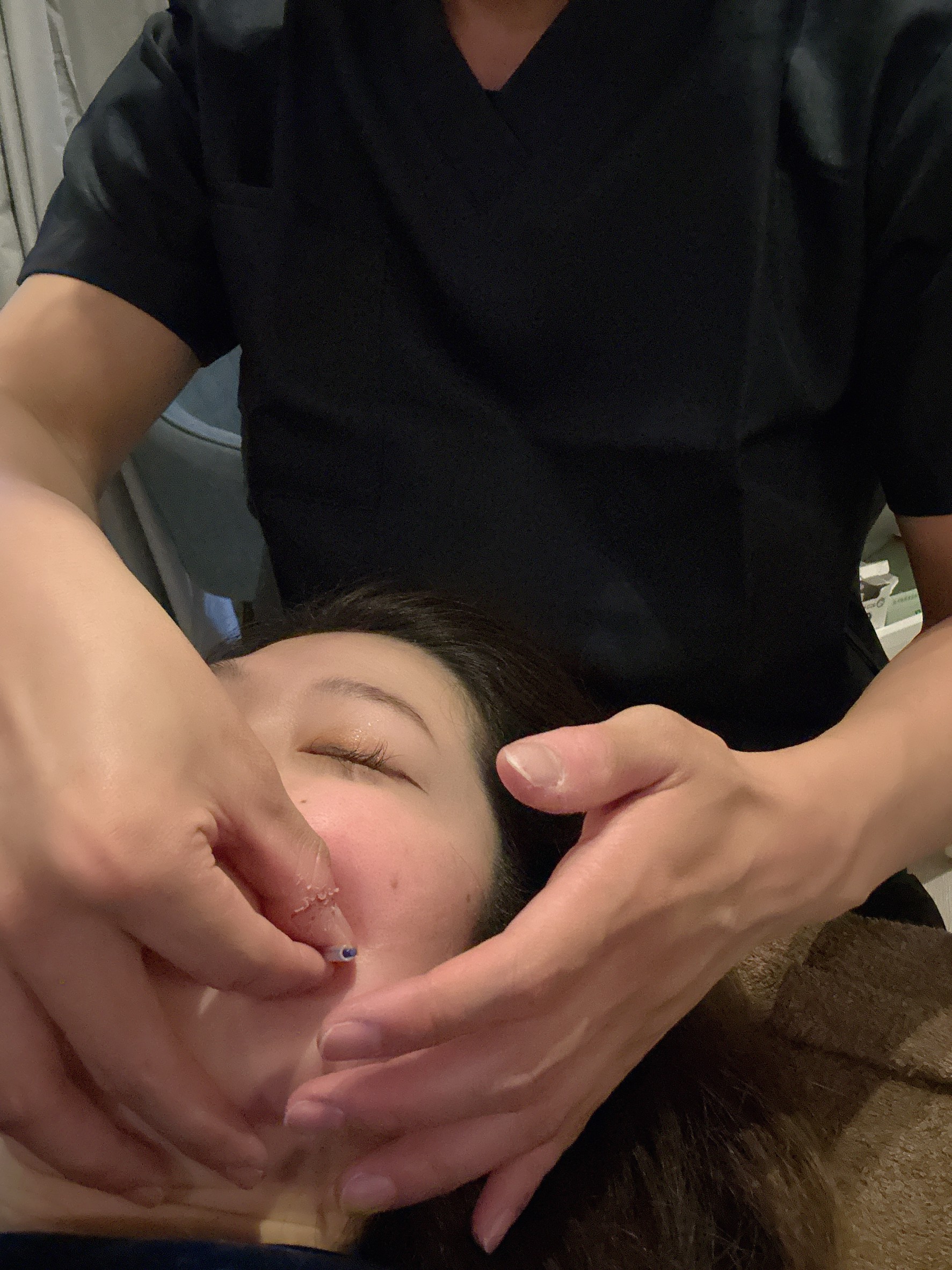 HARI－熊－ 【初回限定 8,900円→5,800円】肌再生特化美容鍼　のメニュー画像
