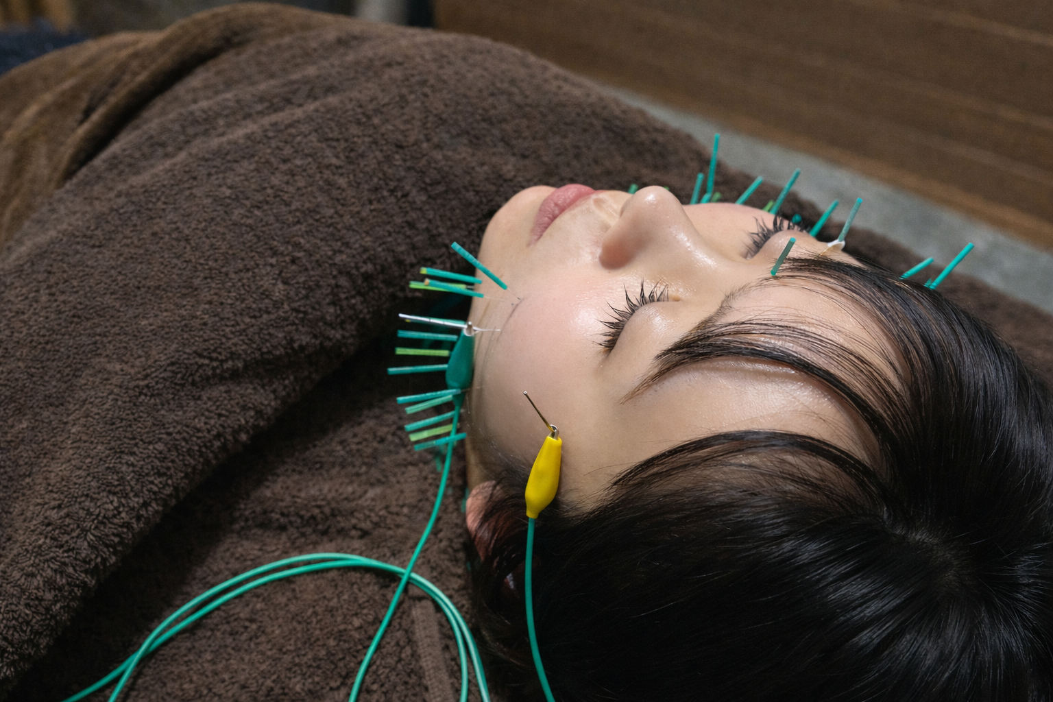 鍼灸リラクゼーションサロン　Leafy（あおき温泉内） 【温泉美容鍼ベーシック】女性人気No.1のメニュー画像