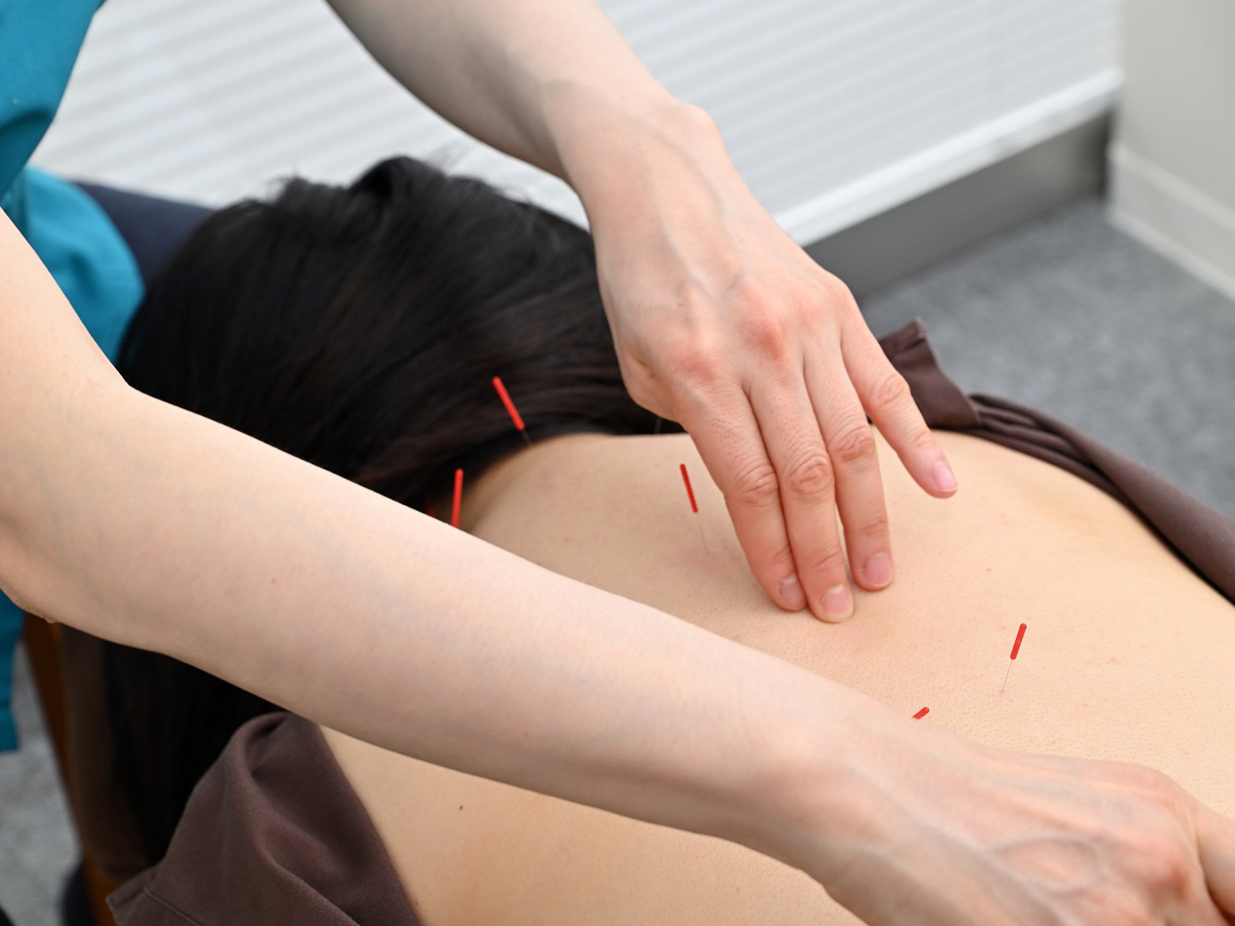 日本橋　EDO鍼灸院 再来院　基本鍼灸40分のメニュー画像