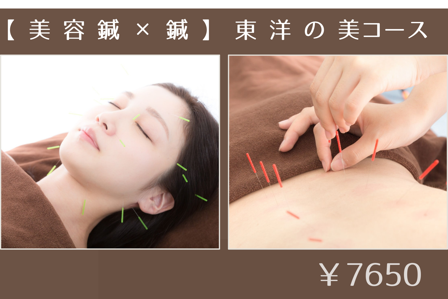 那覇市新都心スマイルなごみ鍼灸整骨院 美容鍼【東洋の美】のメニュー画像
