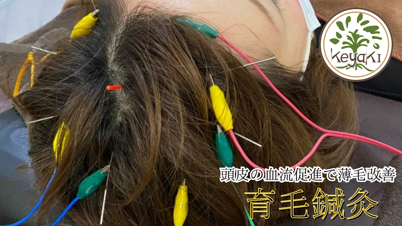 鍼灸・美容鍼サロンKEYAKI　自由が丘院 【初回限定】育毛鍼灸  ～薄毛で悩んでる・AGA治療で変化を実感できない・薬の副作用を気にしたくない～のメニュー画像