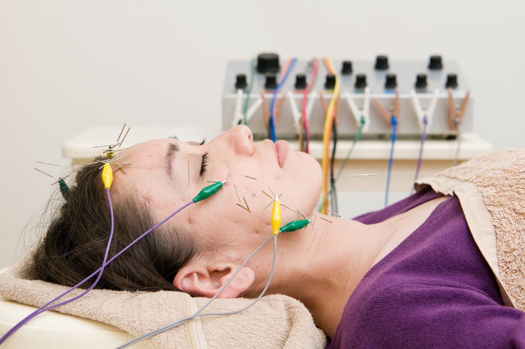 鍼処SHIRAKAWAなごや院中川　(ルート治療専門院） リフトアップ美容鍼のメニュー画像