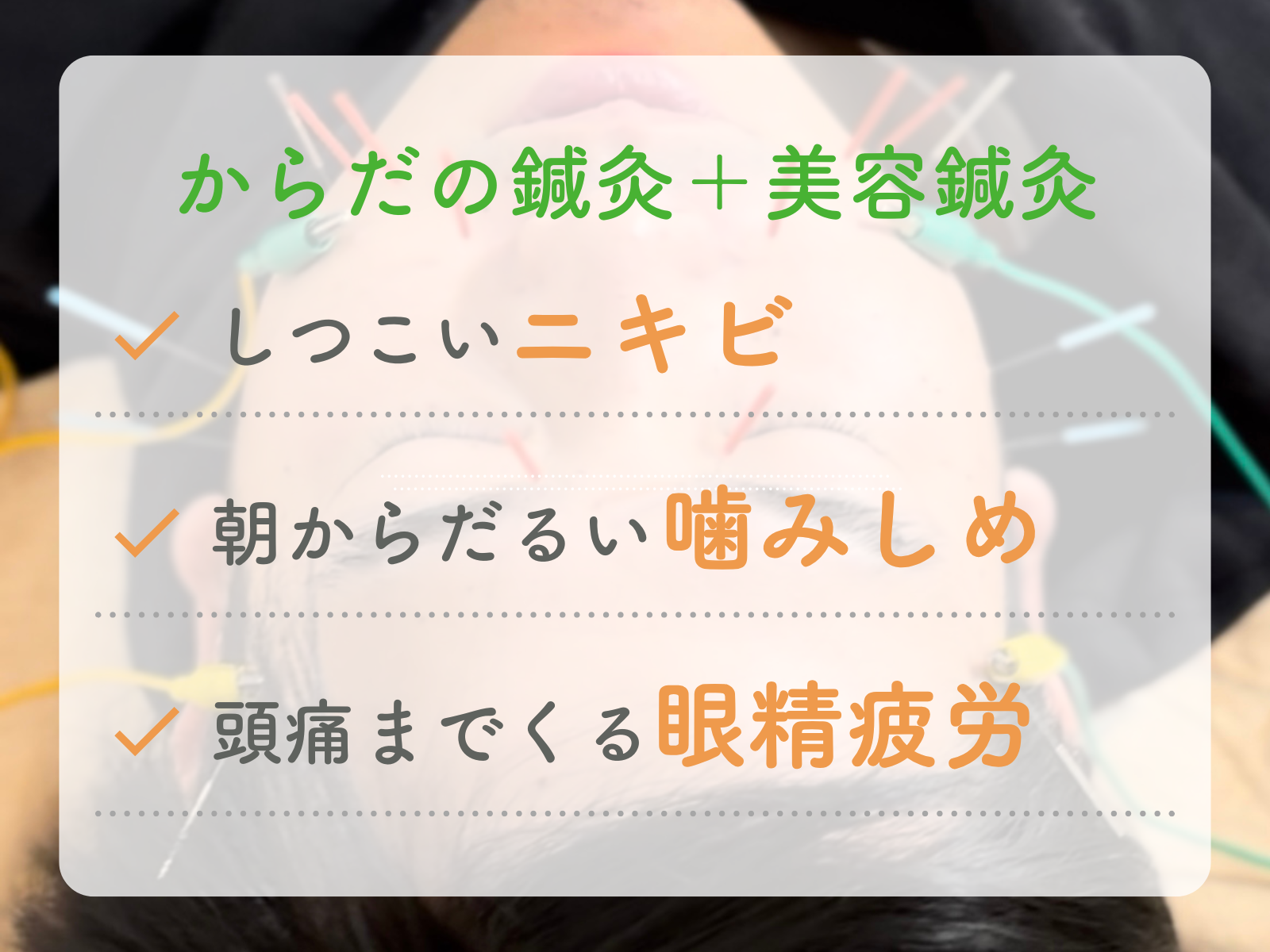 【東洋鍼灸専門】鍼灸院はりえくぼ｜肩こり・腰痛・自律神経ケア からだの鍼灸＋美容鍼灸 ¥9,900のメニュー画像