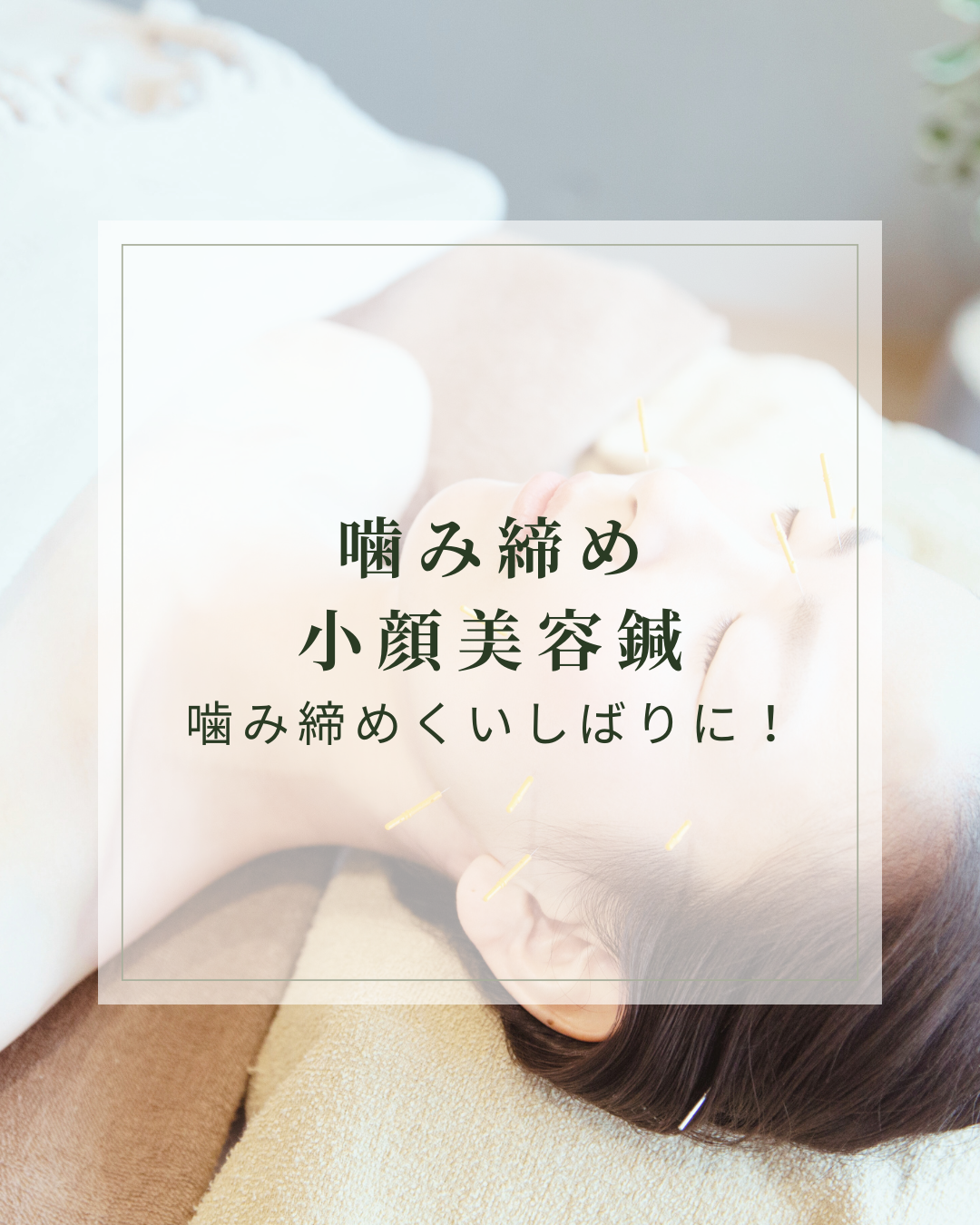 はり灸サロン　めぐりプラス 【くいしばりのお悩み専用】上半身＆お顔の鍼灸コースのメニュー画像