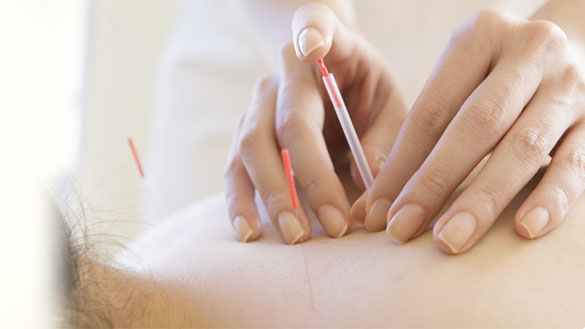 きむら治療院 鍼灸（再診）のメニュー画像