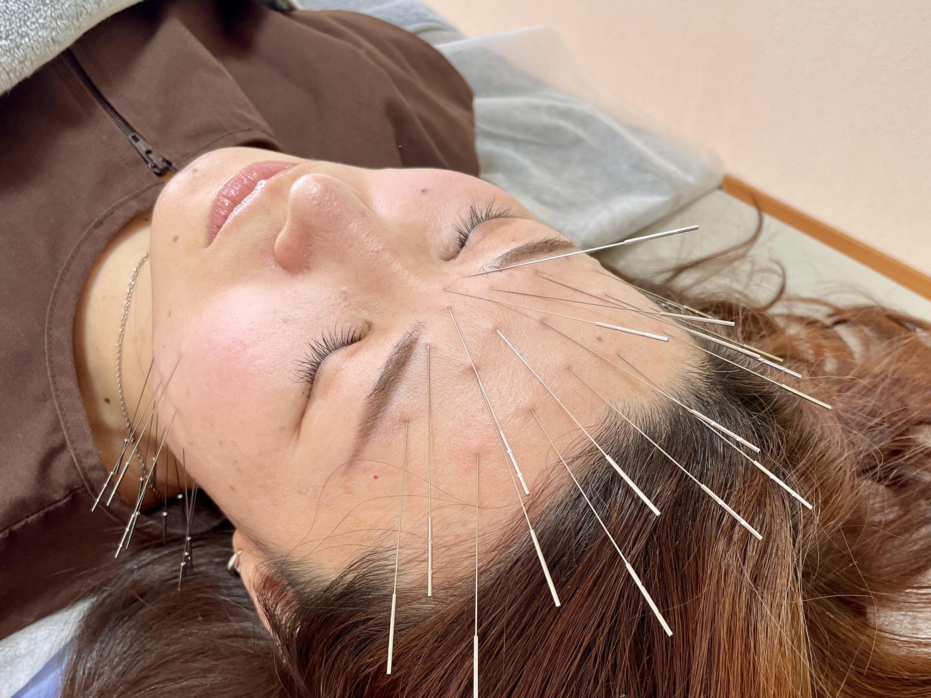 鍼灸院ひかり　岐阜ルート治療院 【メンテナンス】40分コースのメニュー画像