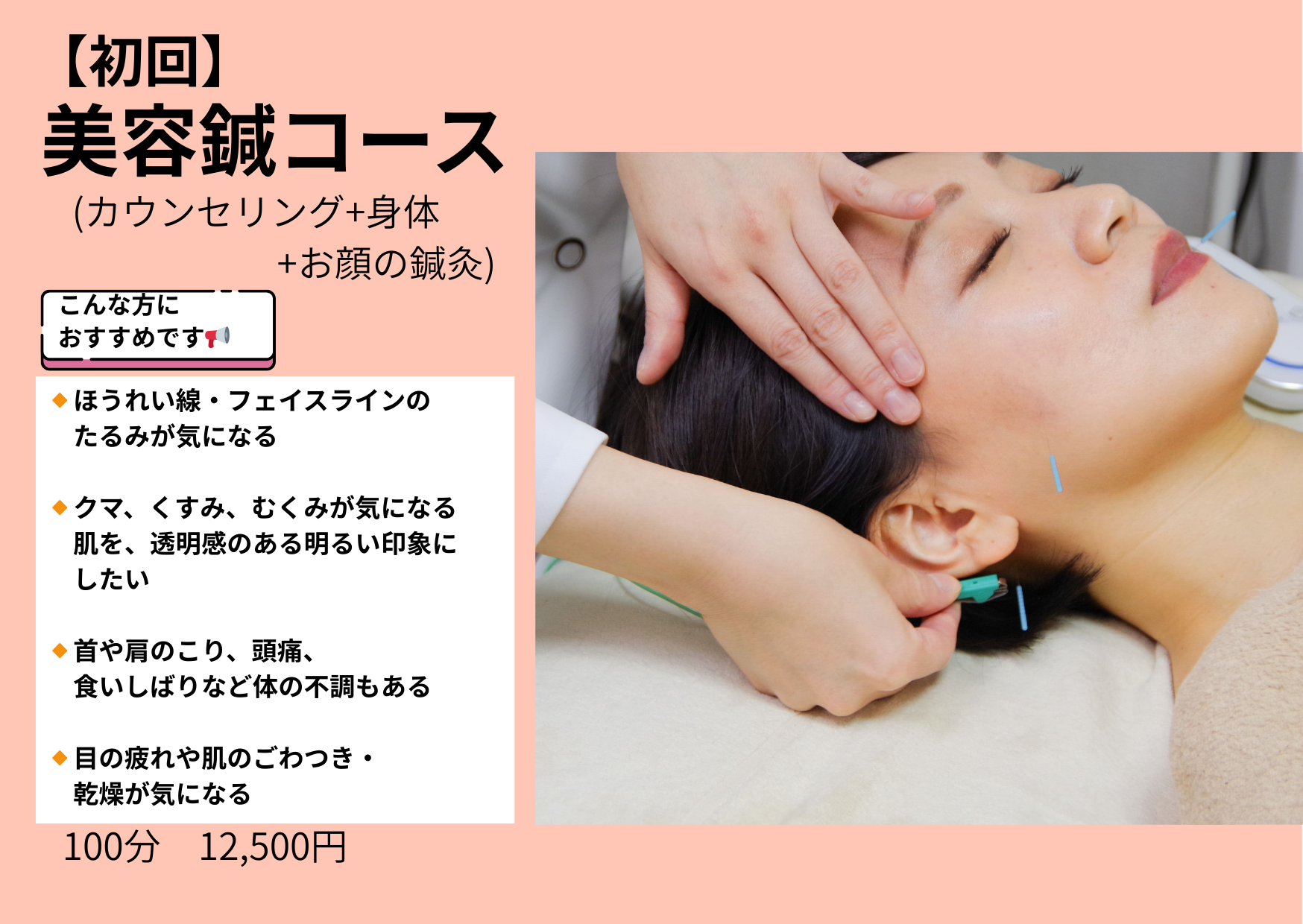 にじいろ鍼灸マッサージ 【初回】美容鍼コースのメニュー画像