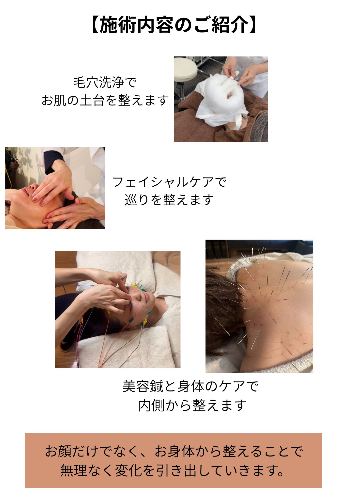 美容鍼灸サロン マックスビューティー 【MYDO掲載】春の美肌スタートケア｜全身から整えるトータル美容鍼　3・4・5月限定！のメニュー画像