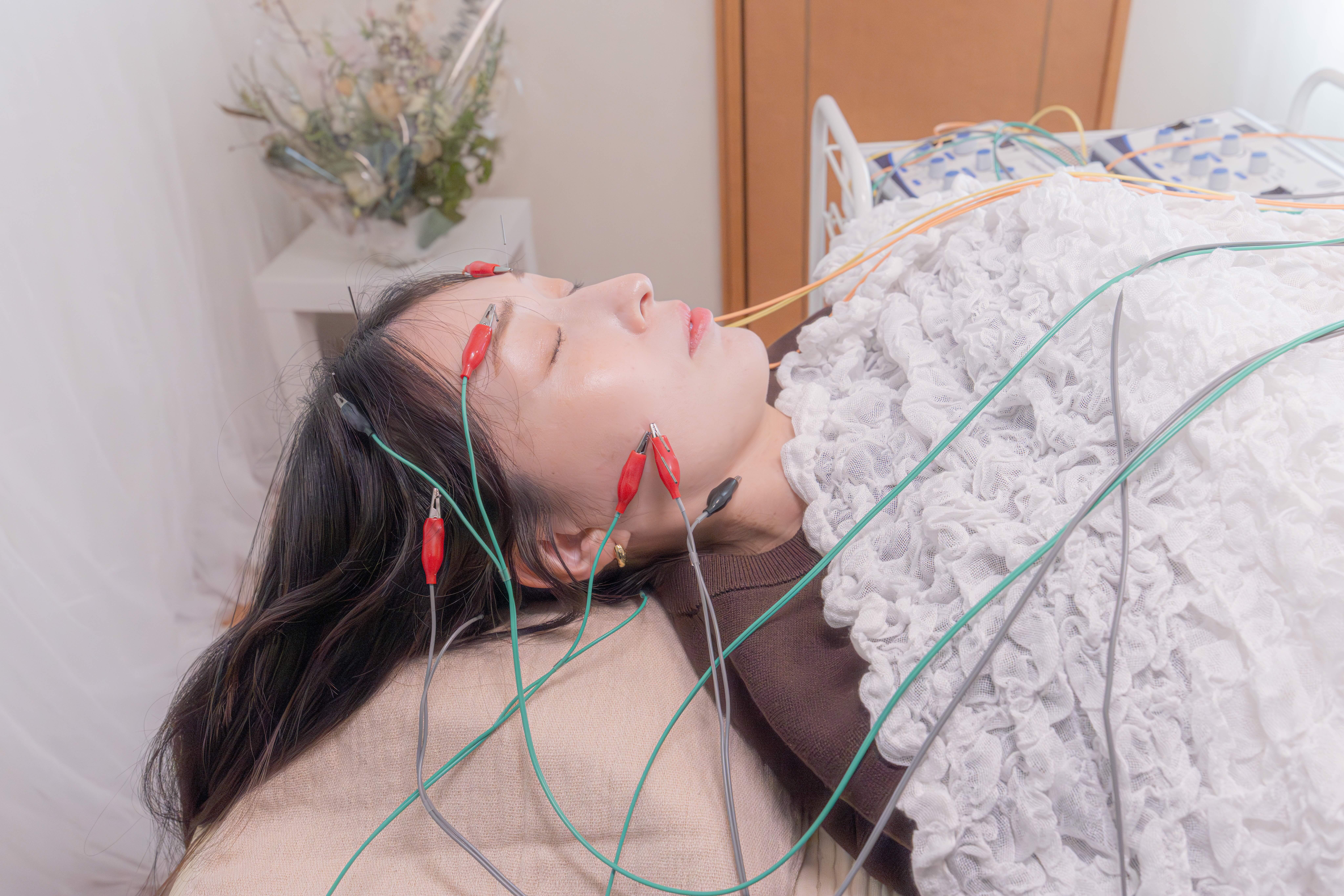 あいのMeguri鍼灸院 美容鍼のメニュー画像