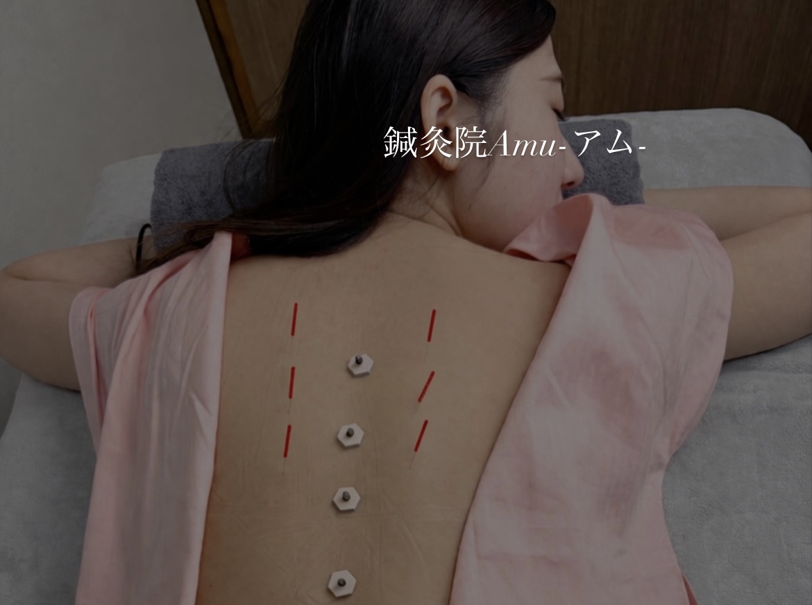 鍼灸院Amu-アム- ▶初回【耳鳴り特化】鍼と灸でトトノウ全身鍼灸のメニュー画像