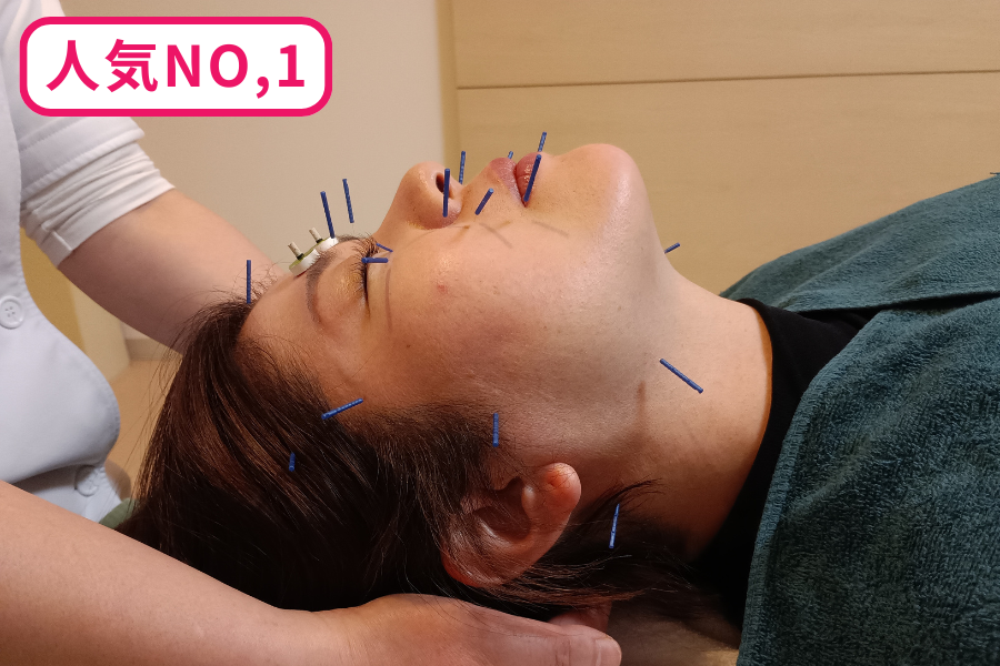 りり鍼灸院 ▶初回限定　【人気No,1】美容鍼 ＆ 背中の鍼（首〜腰の鍼）のメニュー画像