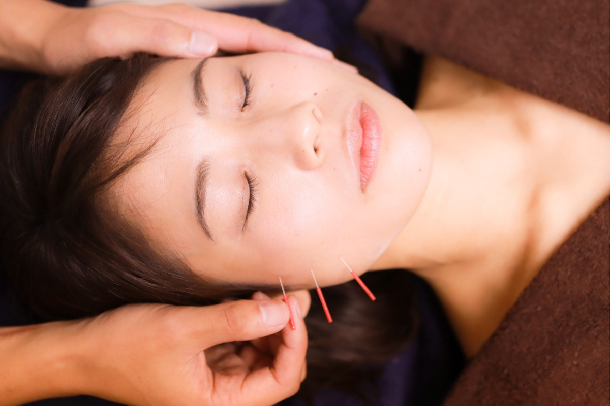 桶川朝日鍼灸院 美容鍼灸のメニュー画像