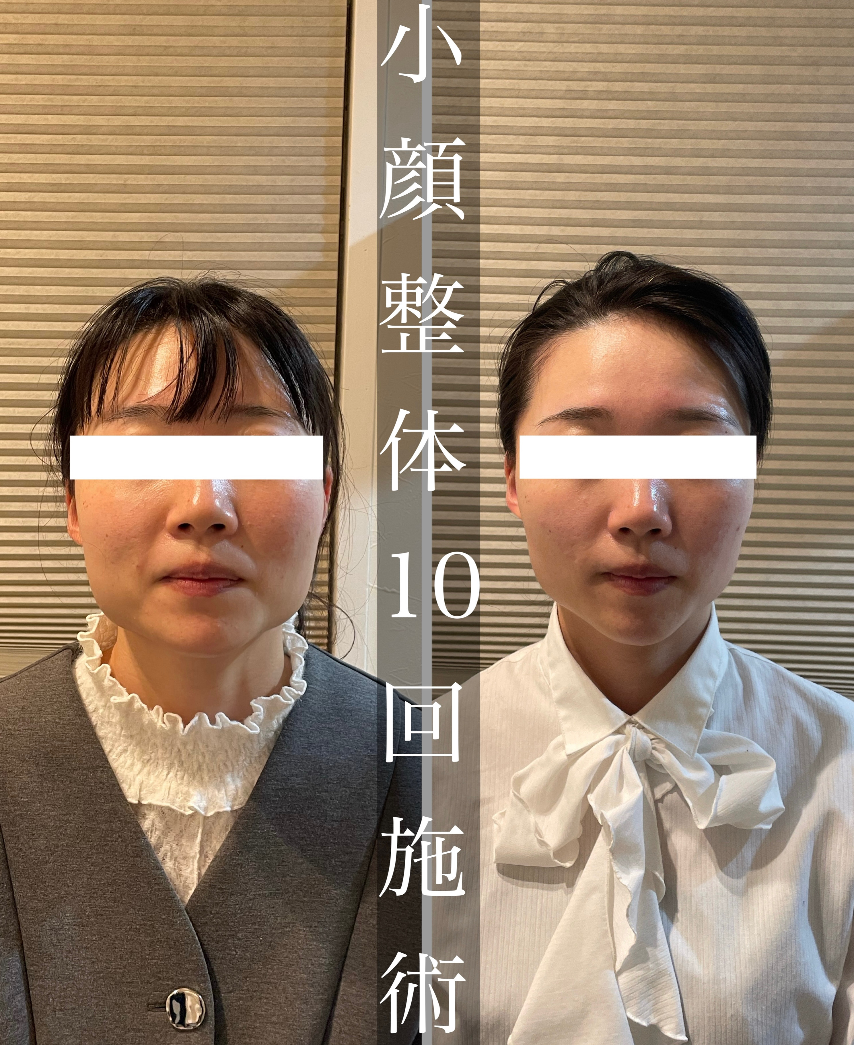 鍼灸整骨院Refine 小顔整体　初回体験￥12000→￥4980のメニュー画像